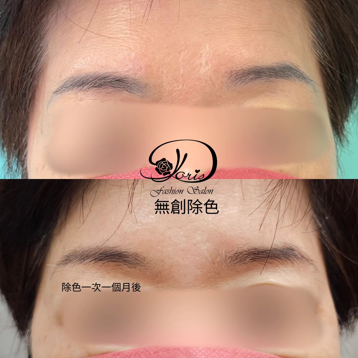 【眉毛除色】現在的除色技術,無傷口正常洗臉化妝 痛感較傳統破皮洗眉低很多