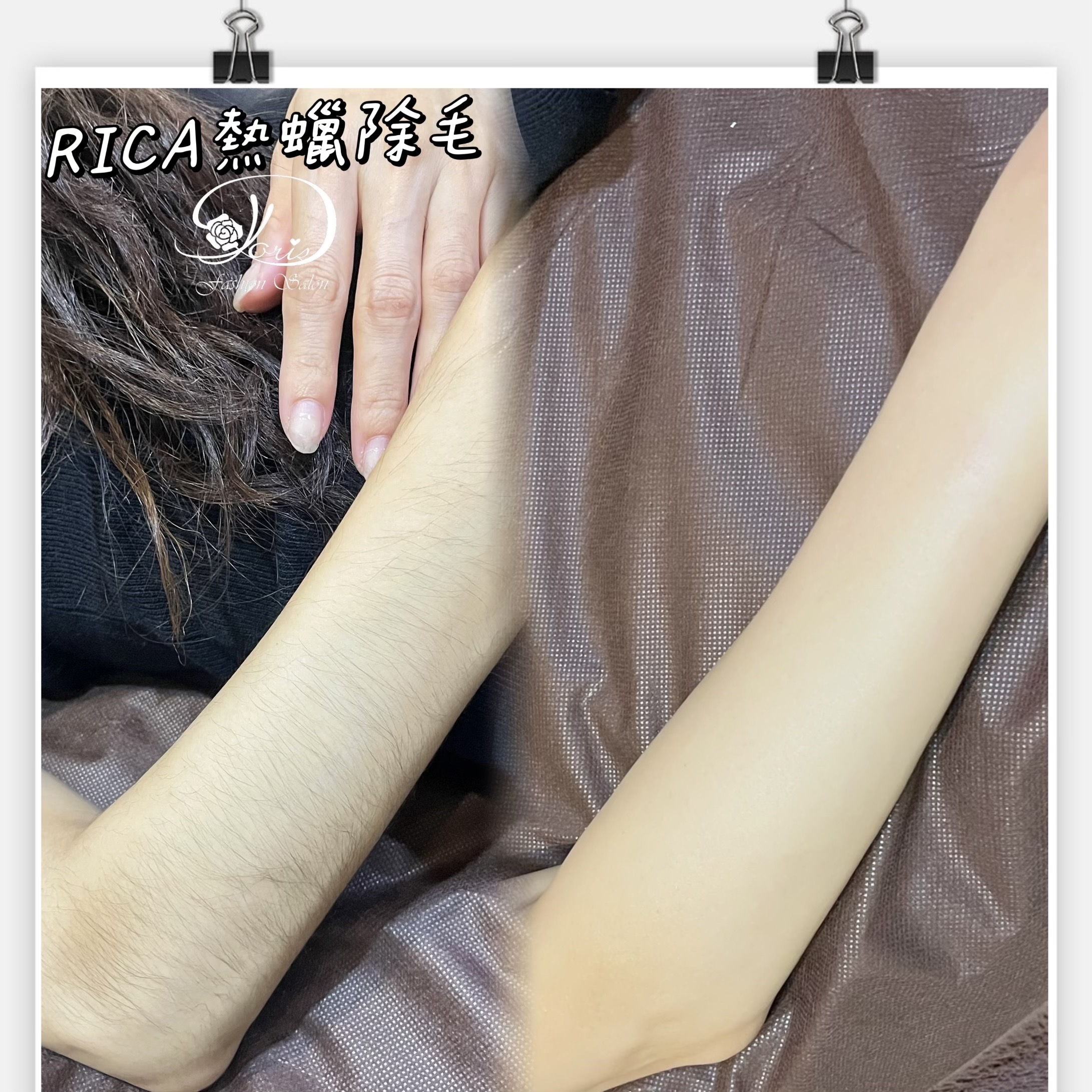 【RICA熱蠟除毛】纖細的手怎麼能容許手毛存在(≧▽≦))熱蠟除毛完立即光滑肌，自己看了心情好~
