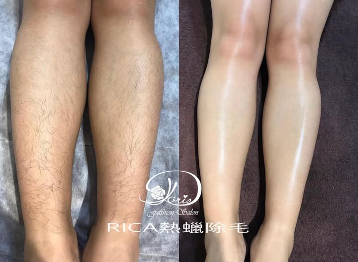 【台南熱蠟除毛】熱蠟可以使肌膚透亮又能立即解決毛髮問題