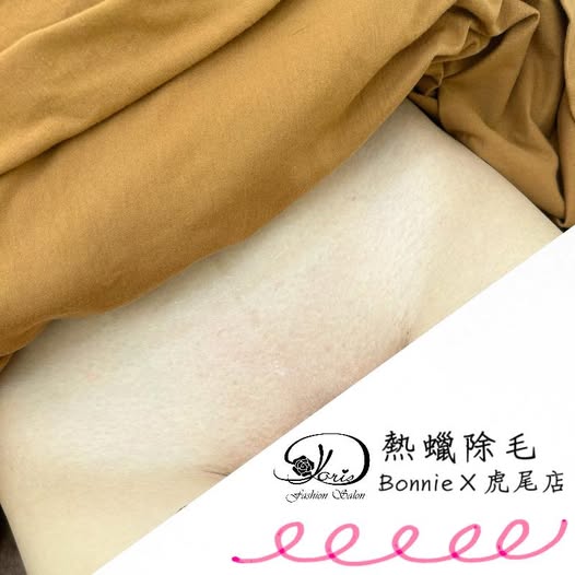 【虎尾孕婦除毛】除毛不只是除毛，更是一趟護膚旅程