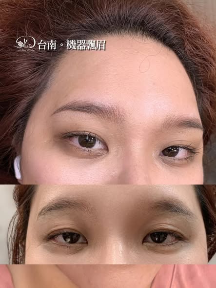 【台南飄眉】在幾乎無毛的眉頭，用機飄做仿真毛流做到自然銜接
