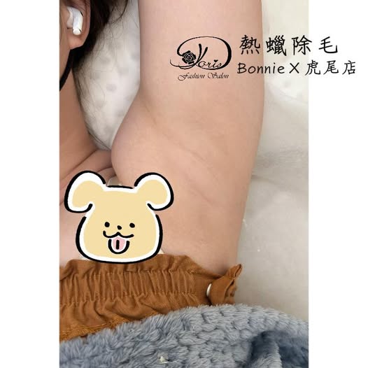 【雲林熱蠟除毛】除完後沽溜溜的肌膚很滑嫩